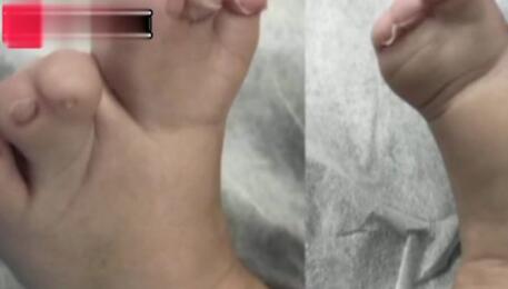 赢在起跑线上的孩子视频搞笑,萌娃发量惊人好像蒙奇奇