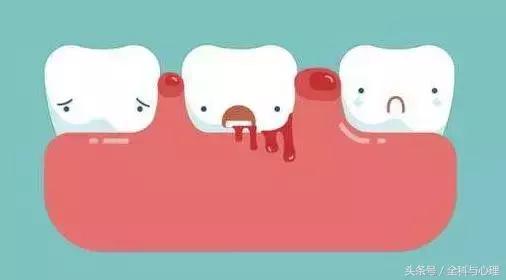 上火口臭牙龈出血怎么解决,牙龈上火出血用什么牙膏好