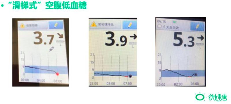 空腹运动低血糖正常吗,半夜低血糖吃了糖算不算空腹