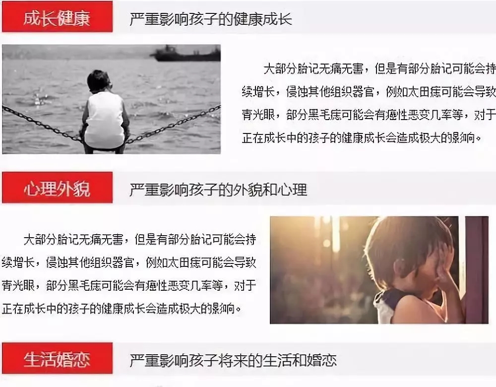 邯郸治疗胎记最好的地方,河北黑胎记的治疗方法