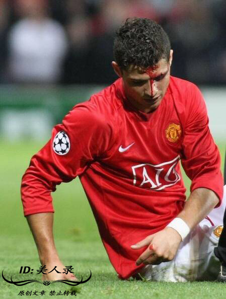 c罗的眼角被撞血流如注,眼角被撞一道口子