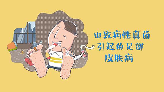 脚气病的预防方法有哪些,脚气的预防