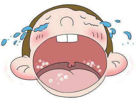 新生儿鹅口疮怎么预防和处理,新生儿鹅口疮引起的原因是什么