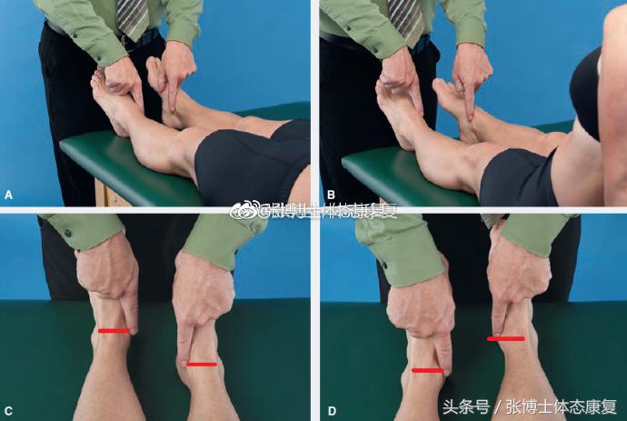 矫正长短腿去哪里矫正,体态矫正腿