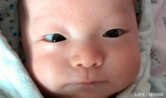 宝宝有点斗鸡眼多大能恢复正常,宝宝眼睛为什么会有斗鸡眼现象