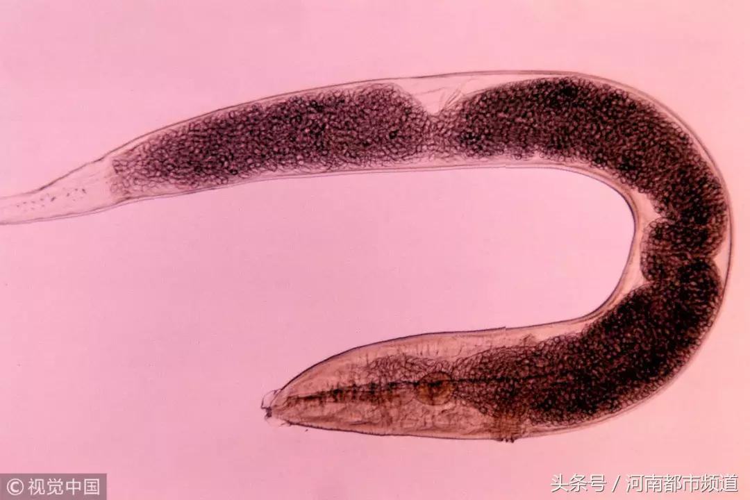 小孩屁股里有白色小虫抹什么药,孩子屁股里有白色小虫子用什么药