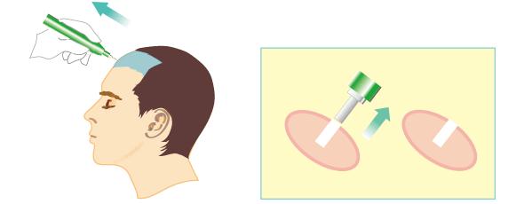 原来头发是绿的然后染橙色,种头发能和原来头发一样吗