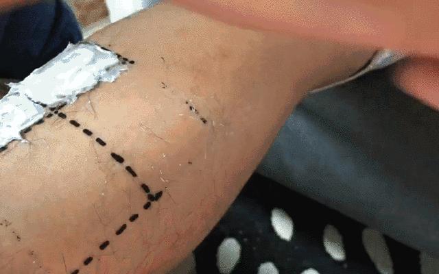 要想穿得少，脱毛要趁早！我用10款脱毛产品薅光了男同事的腿毛