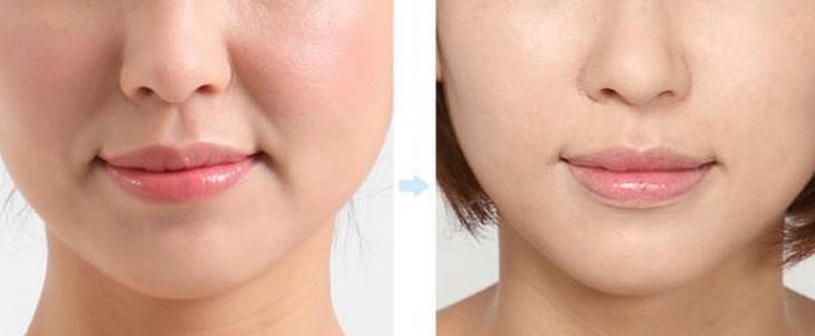 韩国牌子眼霜抗老去皱保湿,韩国平价眼霜精华全脸用的