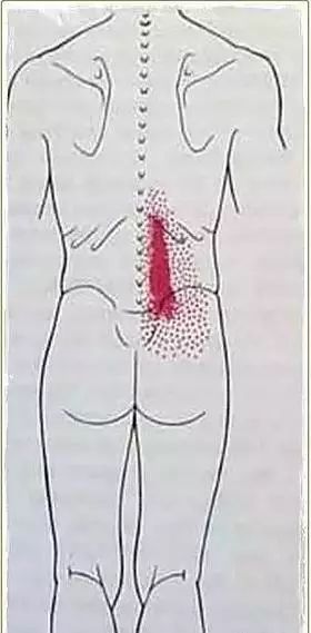 锻炼腰部肌肉时盆骨后侧不舒服,锻炼竖脊肌改善骨盆前倾