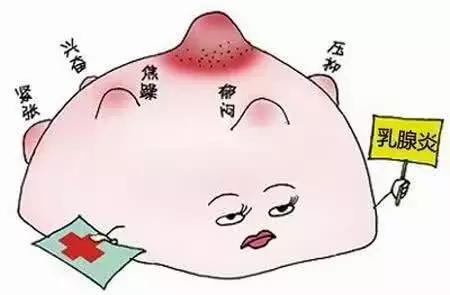 产妇乳腺化脓原因,产妇突然高烧乳腺炎