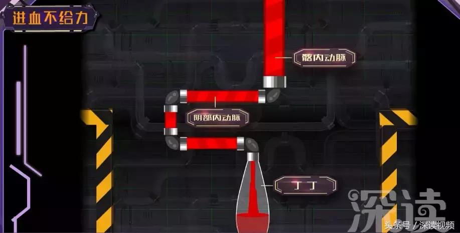 谁让你“兄弟”不给力，谁让你“痿”靡不振？阳痿诱发因素知多少