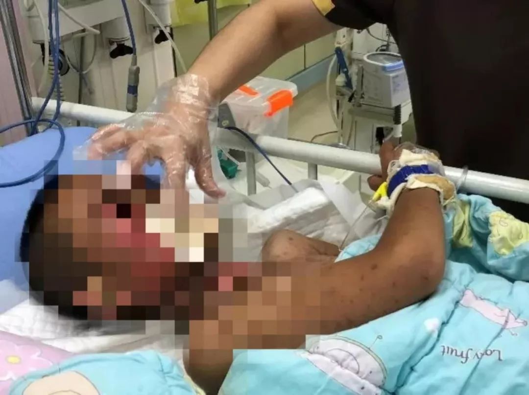 面对满脸血污、全身溃烂的孩子，哈尔滨女医生一个动作温暖了整个朋友圈