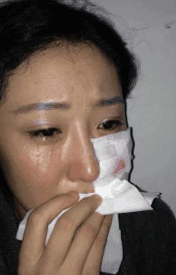 因拍戏受伤的十大明星,因拍戏而受伤的十大明星