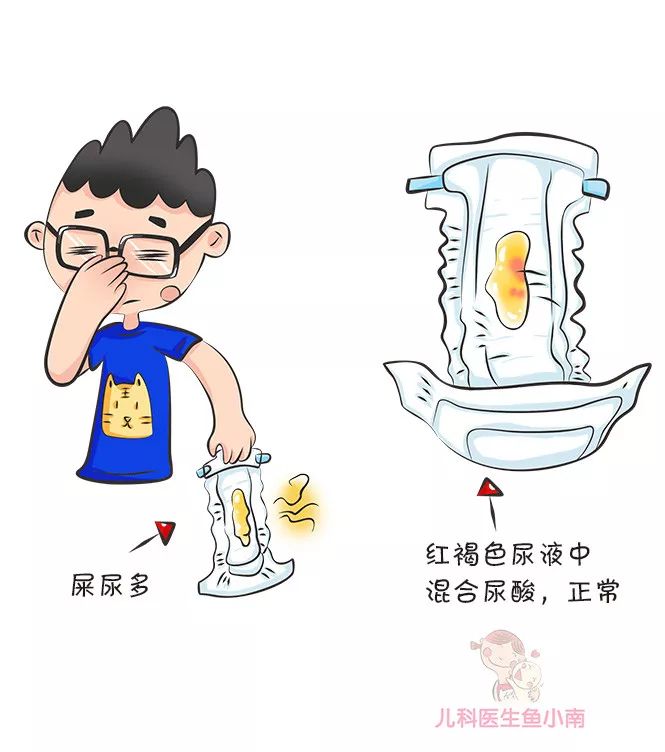 宝宝便便看出健康大问题,宝宝便便形状代表各种情况