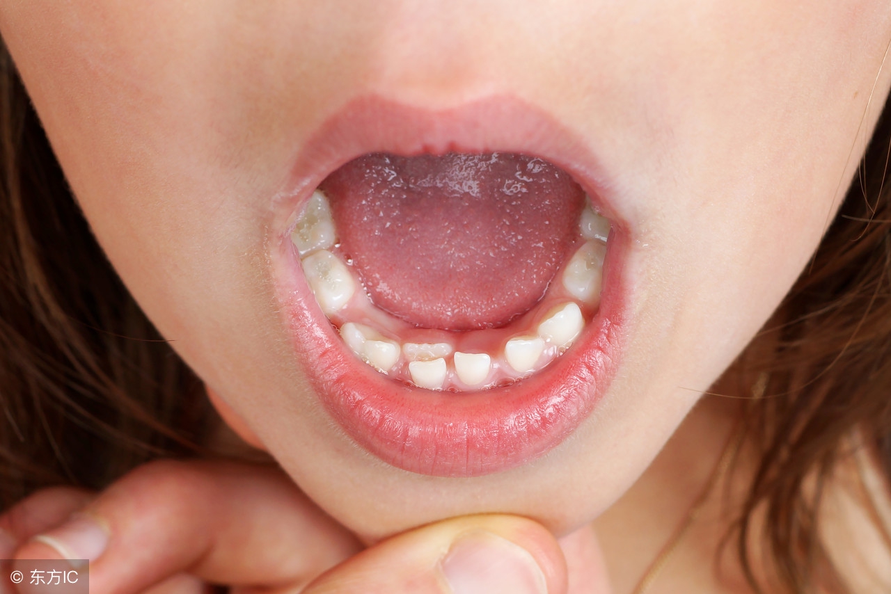 孩子刚刚换牙长歪了怎么补救,孩子换牙怎么才能确保不长歪