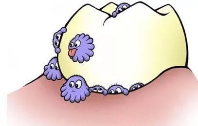 龋病科普——小洞不补，大洞吃苦！