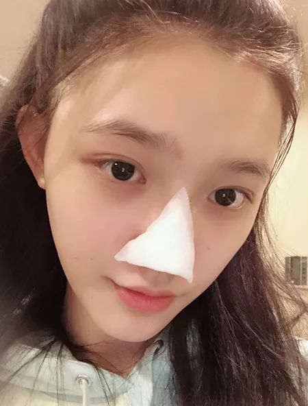 林允谈黑自己视频,林允自曝圈内现象