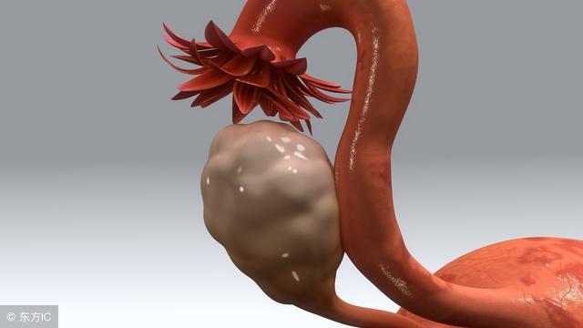 宫颈息肉有原因，这三个检查项目需要做