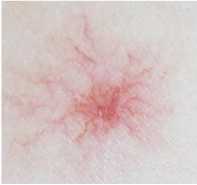 共抗乙肝共建绿色家园