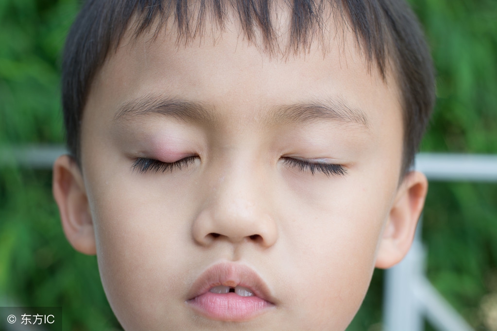 长针眼导致失明,针眼不治能自愈吗