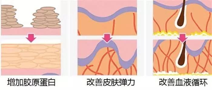 埋蛋白线有什么用,脸上埋蛋白小线真的紧致吗