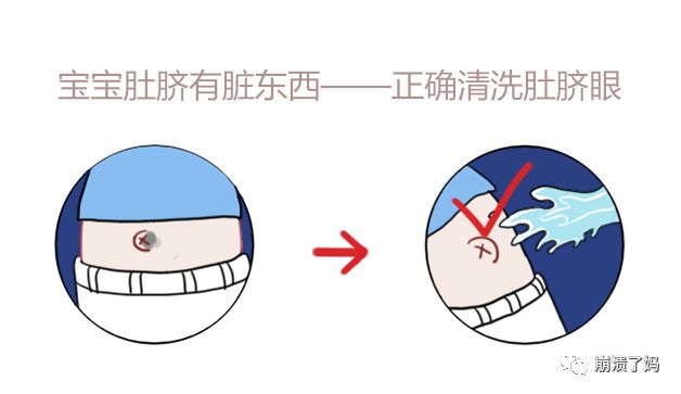 宝宝爱抠妈妈肚脐眼是什么原因,宝宝爱抠肚脐眼抠肿了