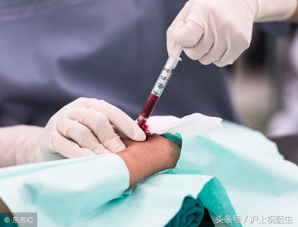 为什么体检抽了六管血,抽出来的血是黑色的