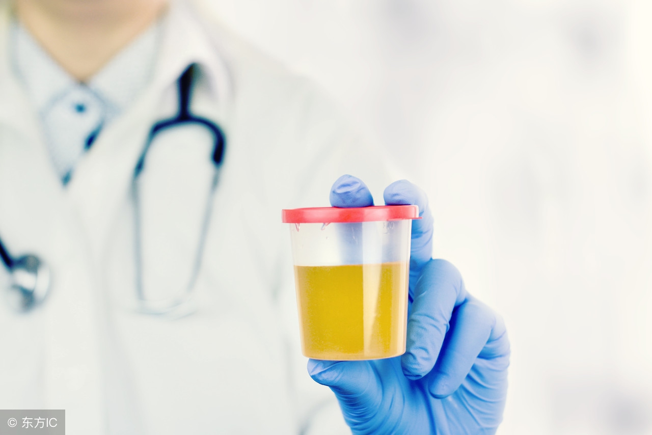 验尿主要是测试什么病,验尿都有什么讲究