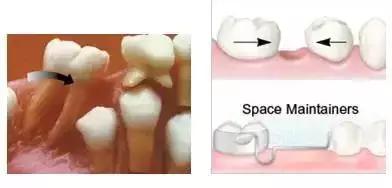 乳牙拔出后牙根却不完整,乳牙拔掉了新牙迟迟不出