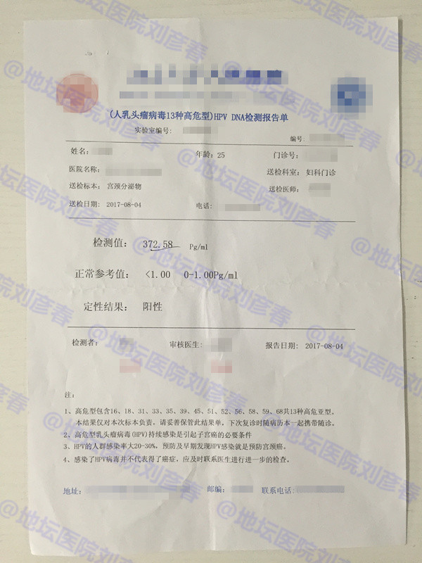 tct查出ascus的检出率高吗,宫颈tct结果ascus什么意思