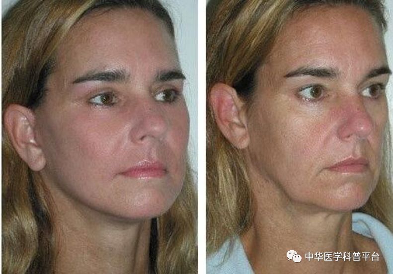 整形课,整形为什么越来越难看