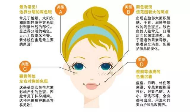 一分钟自测斑型,如何辨别自己属于哪类斑