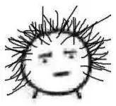 脱发比较严重的90后,脱发严重发际线越来越高