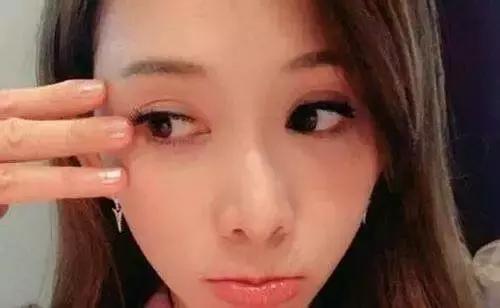 出现第一条鱼尾纹该怎么预防,鱼尾纹是怎么来的