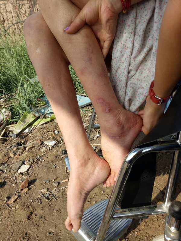 关爱聋哑伴智力障碍儿童,关爱残疾孩子