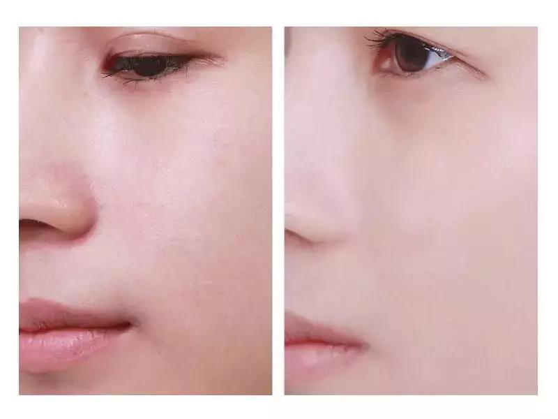 一直被国人瞧不起的老牌国货,老牌国货治好烂脸