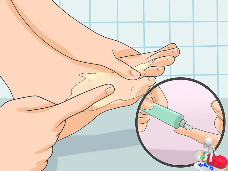 还在为脚臭而发愁吗,这些秘方帮您攻克顽固脚气