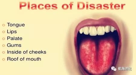 消化内科朱海航,朱海航杭州