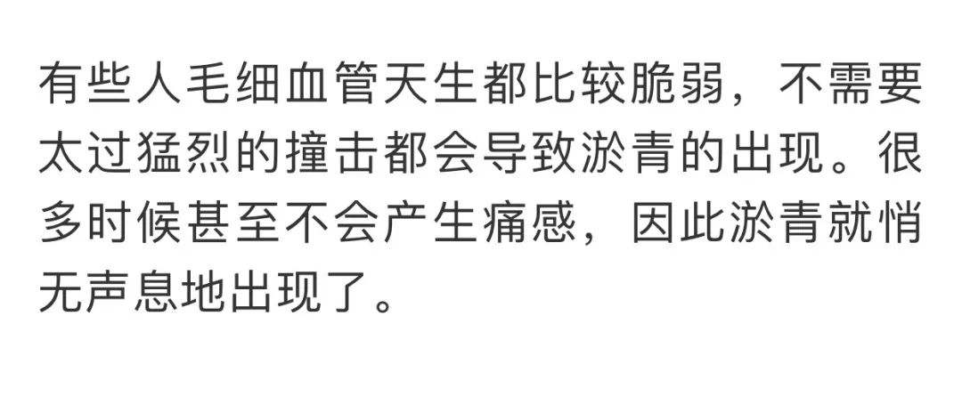 身上不明原因出现淤青是怎么回事,鬼捏青与正常淤青区别
