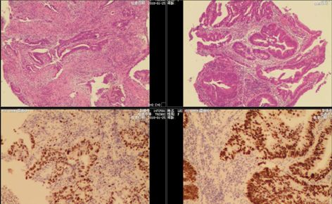 便中带血见于什么疾病,便中带血是黑色的吗