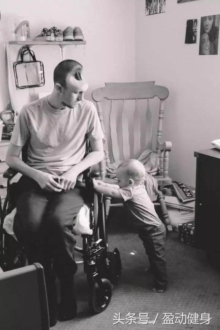 多喝了几杯饮料，半个脑袋没了！年轻爸爸分享恐怖经历