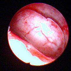 妇科医生都会做宫腔镜吗,妇科宫腔镜检查注意事项