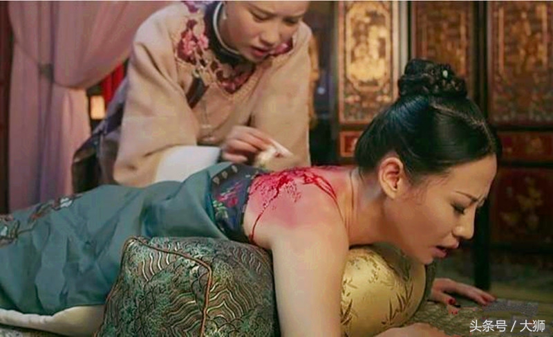 延禧攻略贵妃被泼金汁,延禧攻略高贵妃被金汁烫伤片段