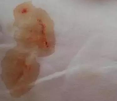 出生没几天的女婴尿布上有血，妈妈惊了！姥姥却很淡定