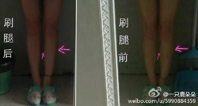 脂肪小腿如何在一个星期内变瘦,坚持10天暴瘦小腿