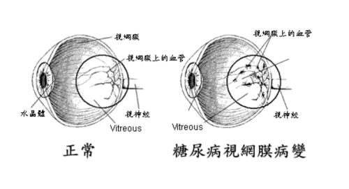 社区能做眼底检查,成人眼底筛查收费标准