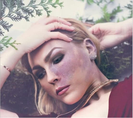 什么情况下胎儿脸上会长胎记,什么原因导致胎儿脸上有胎记