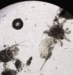 螨虫走开！中疾控检测100%有效，家有小宝、消除过敏源必备