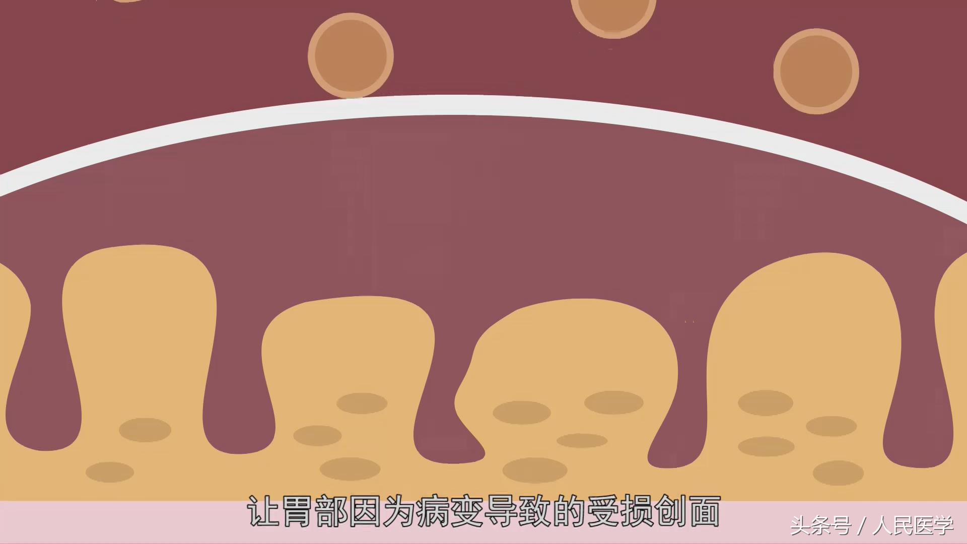 达喜可以治疗胃难受吗,胃不舒服一吃达喜就好了